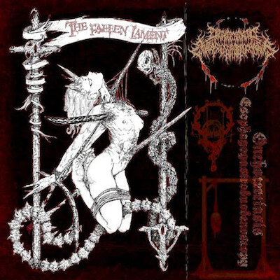 Onchocerciasis Esophagogastroduodenoscopy - The Fallen Lament, Paralytikus Ascends